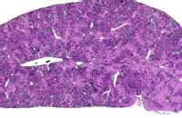Tg Ac Mouse Liver Lesions Erythroleukemia The Digitized Atlas Of