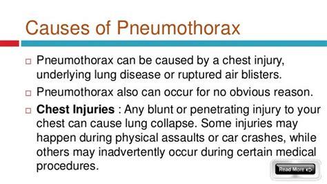 Pneumothorax Collapsed Lung Symptoms Causes And Treatment In Del