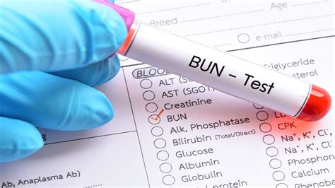 Low Bun Levels And Autoimmune Disease Bun Urea Creatinine Blood