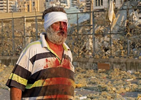 The aftermath of tuesday's blast at the port of lebanon's capital beirut. Massive explosion rocks Lebanon's capital Beirut. Hundreds ...