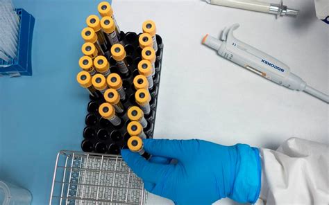 México tiene uno de los índices de muertes causadas por la pandemia más altos del mundo, superado solamente por estados. Primeras pruebas de vacuna china contra Covid-19 dan ...