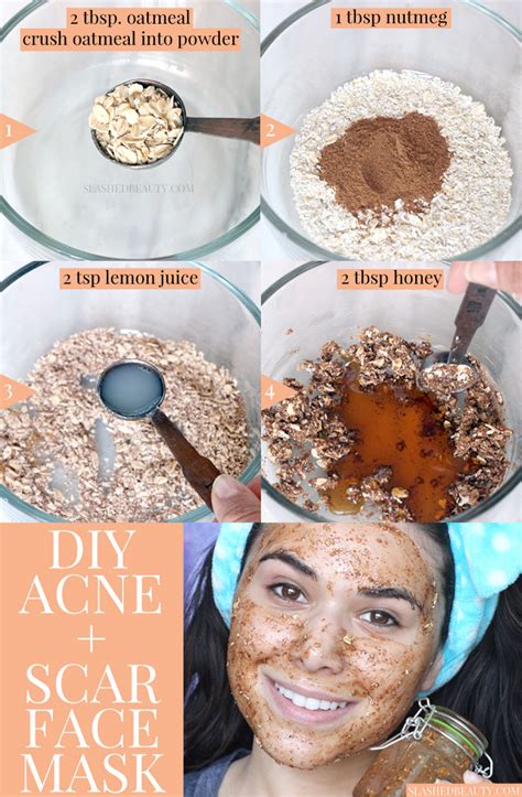 Best Diy Face Mask For Acne And Scars Slashed Beauty