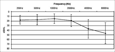 Hearing Thresholds Points Represent Means For All Left And Right Ears
