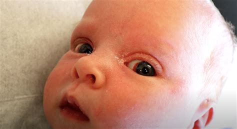 Newborn Care Eyes Philadelphia Fight