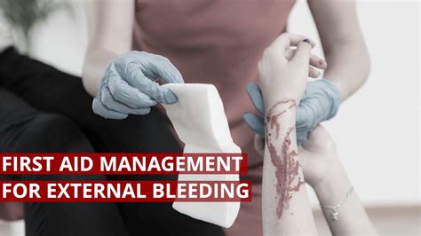 First Aid Management For External Bleeding Firstaid Lifesaver Youtube