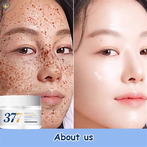 Whitening And Freckle Cream Moisturizing Fading Spots Brightening Skin Hydrating Niacinamide