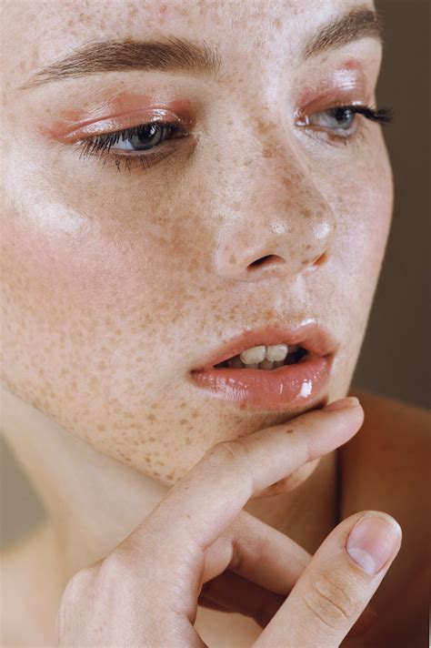 Freckles On Lips Causes Risks And Remedies