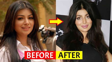 Pin On Actresses Surgery Before And After Photos