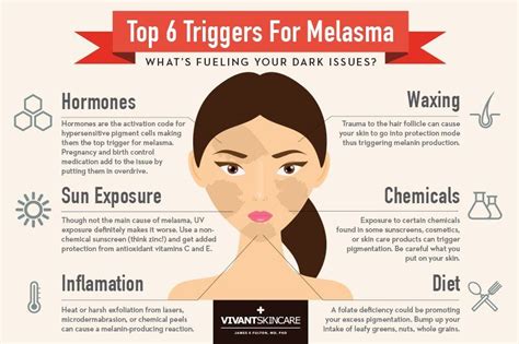 Causes Of Melasma In Males Mercy Microblog Diaporama