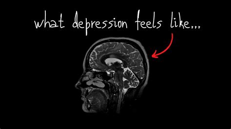 What Depression Feels Like Typical Indicators Of Anxiety Moenguy