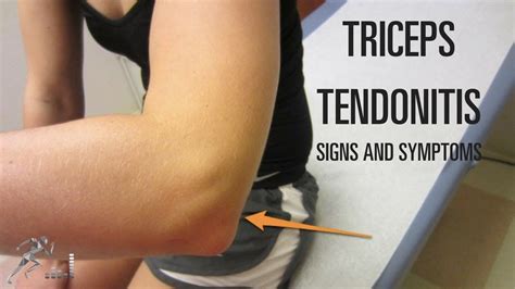 Triceps Tendonitis Signs Symptoms And Treatment Options Youtube