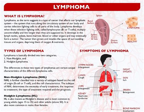 Lymphoma symptoms include fever, excessive sweating, swollen lymph nodes, unintended weight loss, and more. What is Lymphoma? - canceRx