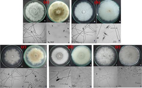 The Morphology Colony Appearance Hypha And Conidia Of Endophytic