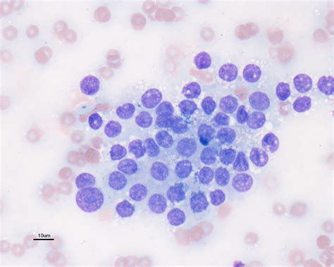 Check spelling or type a new query. Basal Cell Tumor Cat Cytology