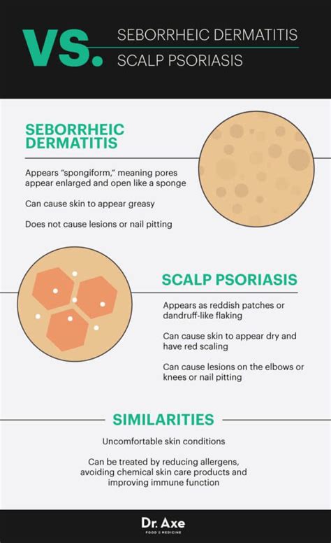 Seborrheic Dermatitis Vs Psoriasis Javsystema