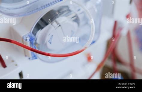Plasmapheresis Dialysis Stock Videos And Footage Hd And 4k Video Clips
