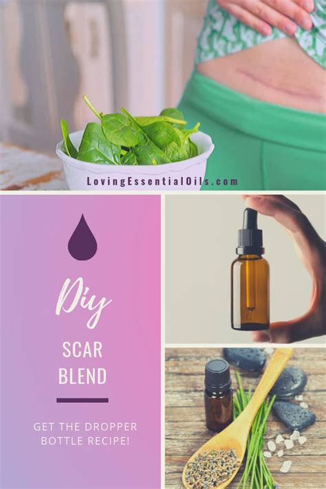 6 Best Essential Oils For Scarring With Scar Reducing Blend Loving