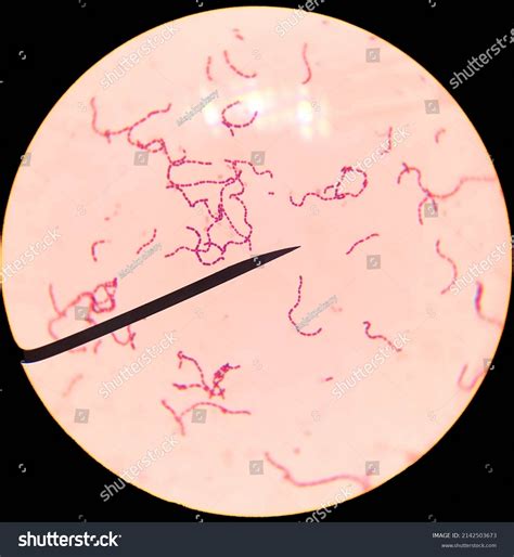 Bacteria Streptobacillus Light Microscope Stock Photo 2142503673