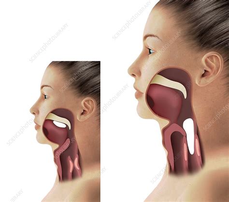 Throat Anatomy Illustration Stock Image C0482728 Science Photo