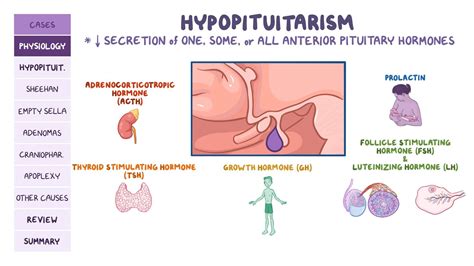 hypopituitarism pathology review video and anatomy osmosis