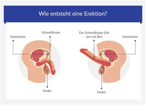 Häufige Ursachen Der Erektilen Dysfunktion Ed • Euroclinix®