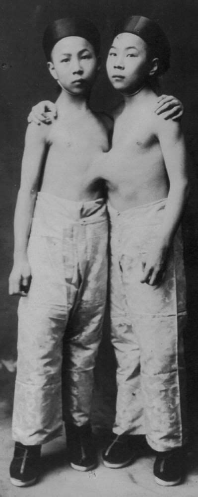 Chang And Eng Bunker Conjoined Twins Human Oddities Old Photos