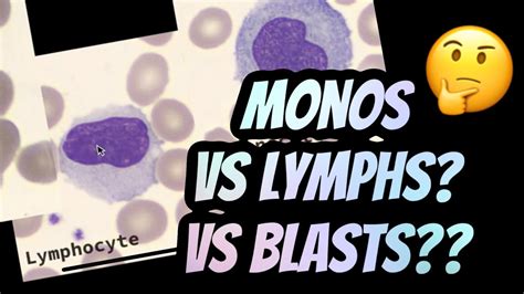 How I Distinguish Between Lymphocytes Vs Monocytes Youtube