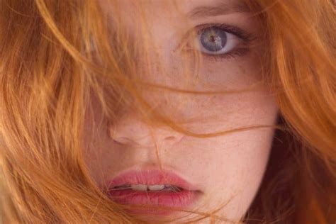 From Ginger To Red Head Gingerism Is A Term I Came Across Term By