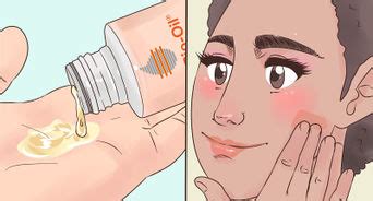 3 Cara untuk Menghilangkan Bekas Luka Sepenuhnya - wikiHow