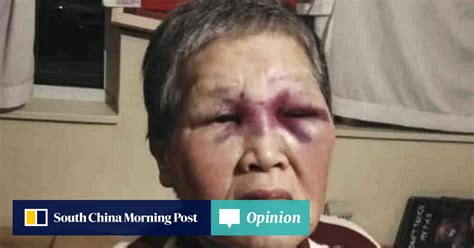 A Chinese Granny And Hate Crime Victim Shows Us ‘enough Is Enough And
