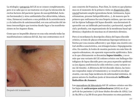 Dermapixel Blog De Dermatologia Cotidianapdf