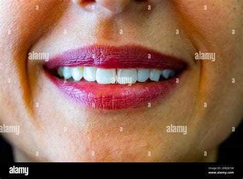 White Teeth Hi Res Stock Photography And Images Alamy
