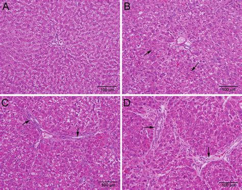 Hematoxylin And Eosin Hande Staining Of Rat Liver Sections Following