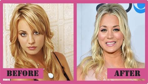 Kaley Cuoco Plastic Surgery Before And After Kaley Cuoco Plastic