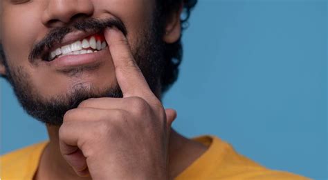 Gum Disease Everything You Need To Know Peel Dental Studio Dentist