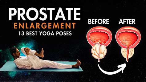 Yoga For Prostate Problems 13 Best Prostate Yoga Exercises Youtube