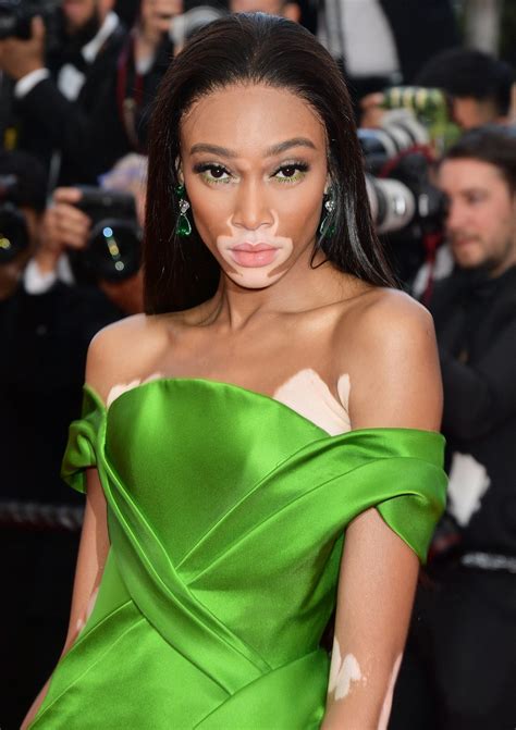 America's Next Top Model's Winnie Harlow Defends Comments 