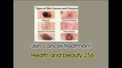Skin Cancer Treatment Method 2018 Therapysurgery Youtube