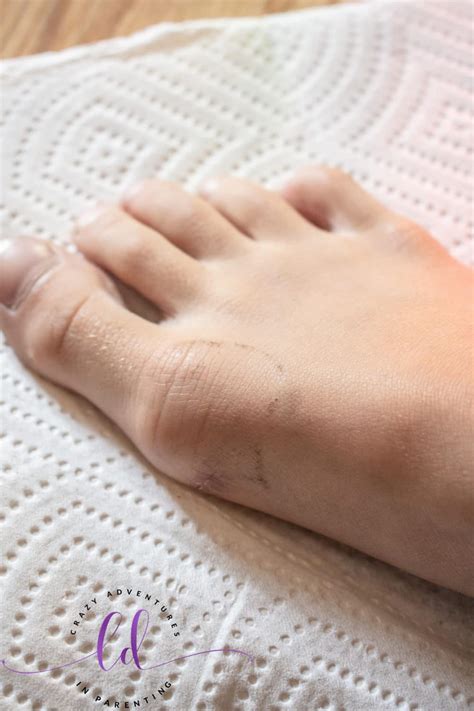 To remove bandage adhesive from the skin, massage almond oil to the area, which also hydrates the skin, or apply vodka to dissolve the adhesive residue. Skin Safe Goo Gone Bandage & Adhesive Remover | Crazy ...