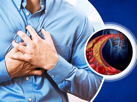 Enlarged Heart Know Various Causes Symptoms And Effects Of This