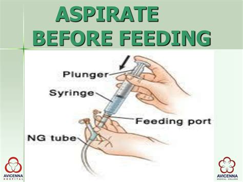 Ppt Naso Gastric Feeding Tube Insertion Powerpoint Presentation Id
