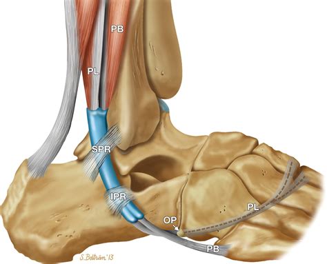 High Resolution Us And Mr Imaging Of Peroneal Tendon Injuries