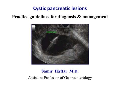 Cystic Pancreatic Lesions Ppt