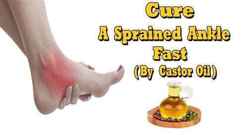 Herbal Treatments For Sprained Ankle Best Herbal Oils To Treat Ankle