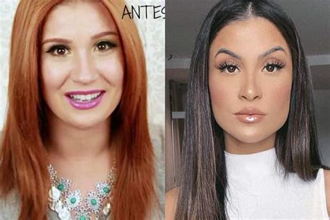 O problema está em quem transforma gente estúpida, sem ou com com conteúdo raso em ícone. A internet está chocada com o 'antes e depois' de Bianca ...