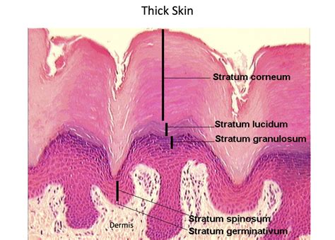 Thick Skin Epidermal Layers Histology