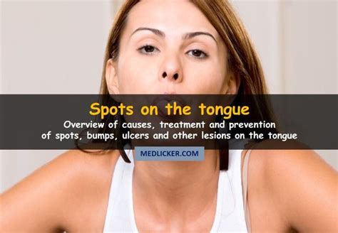Lesions On Tongue Causes Of Spots Bumps Swelling Discoloration And