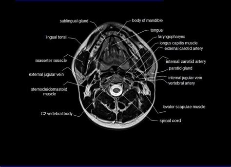 The coronary artery and the circumflex artery are responsible for delivering oxygenated blood to the heart and break it is also the biggest artery in the human body. MRI neck anatomy | free MRI axial neck cross sectional ...