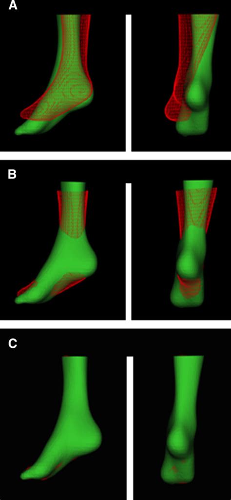 Radiotracer Imaging Allows For Noninvasive Detection And Quantification