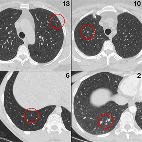What is ct scanning of the body? Characterizing Search, Recognition, and Decision in the ...